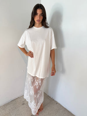 Tshirt Lace Dress